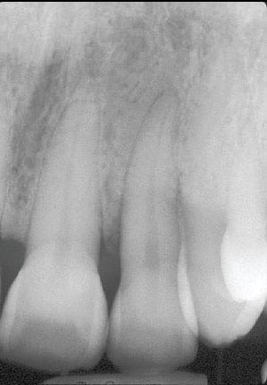 Cosmetic Dentist in Central Park