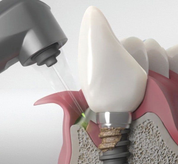 Dentist in Central Park