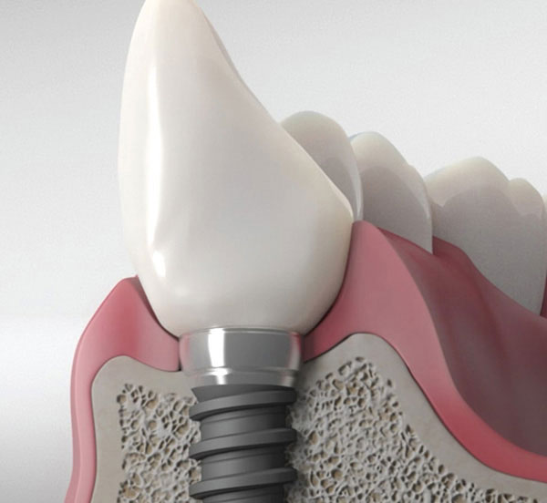 Cosmetic Dentist in Central Park