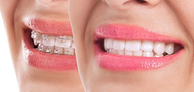 Central Park Dental Aesthetics | Full Mouth Reconstruction, Vivos DNA Appliance and Night Guards