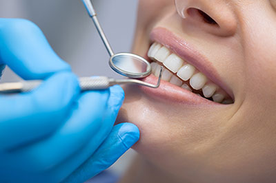 Central Park Dental Aesthetics | Root Canal Treatment, Porcelain Veneers and Treatment of Cold Sores