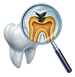 Central Park Dental Aesthetics | Gum Grafting, Composite Filling and Teeth Whitening