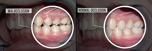 Central Park Dental Aesthetics | Treatment of Cold Sores, TMD and Composite Filling