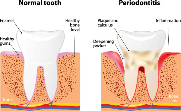 Central Park Dental Aesthetics | Root Canal Treatment, Fluoride Treatment and Same Day Dentistry