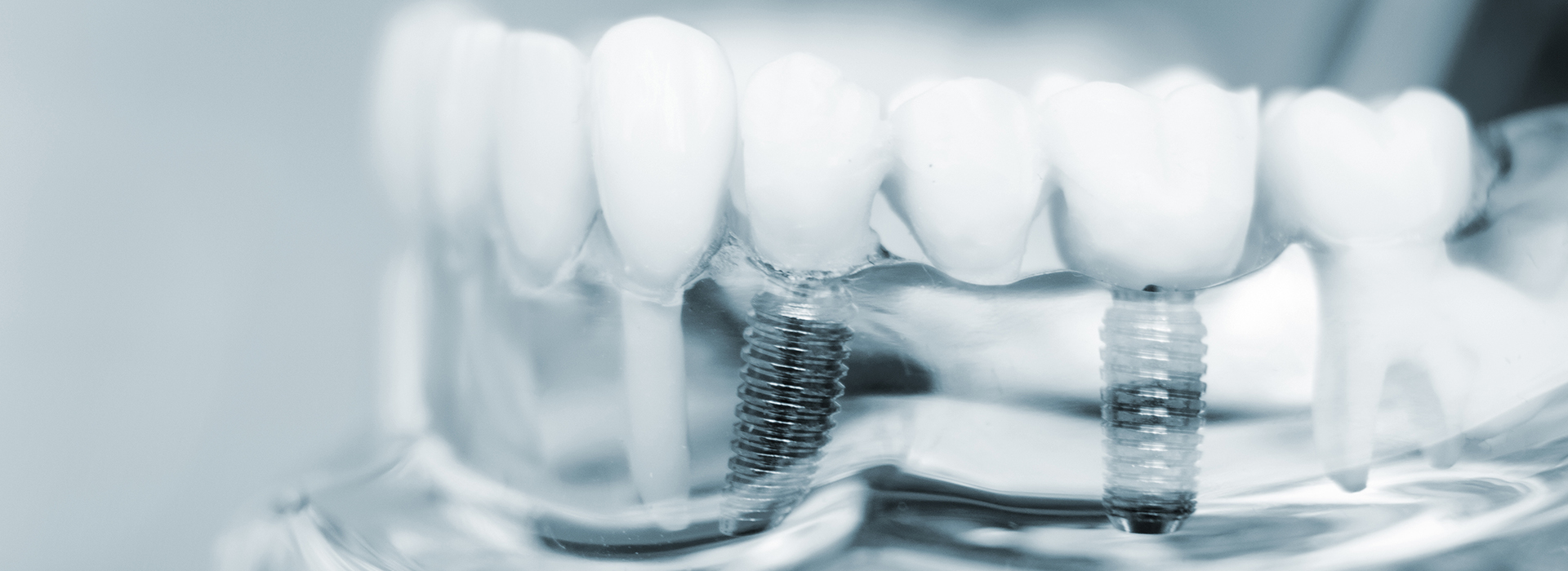Central Park Dental Aesthetics | Dental Implants, Sleep Apnea and Dental Examinations   Cleanings