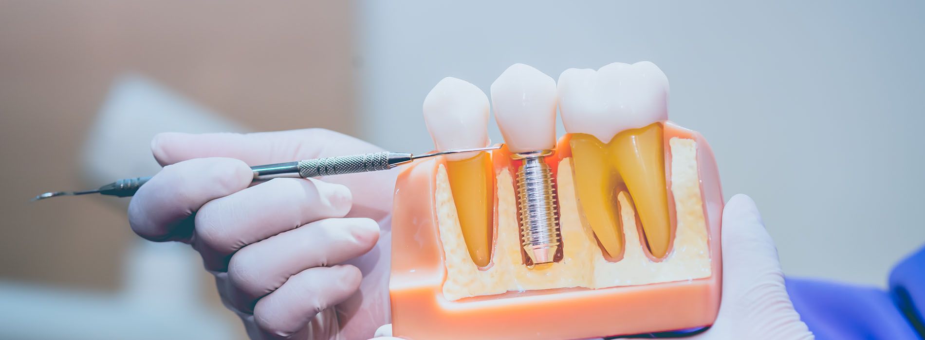 Central Park Dental Aesthetics | TwinLight Periodontal Treatment  TPT , Fluoride Treatment and Laser Dentistry