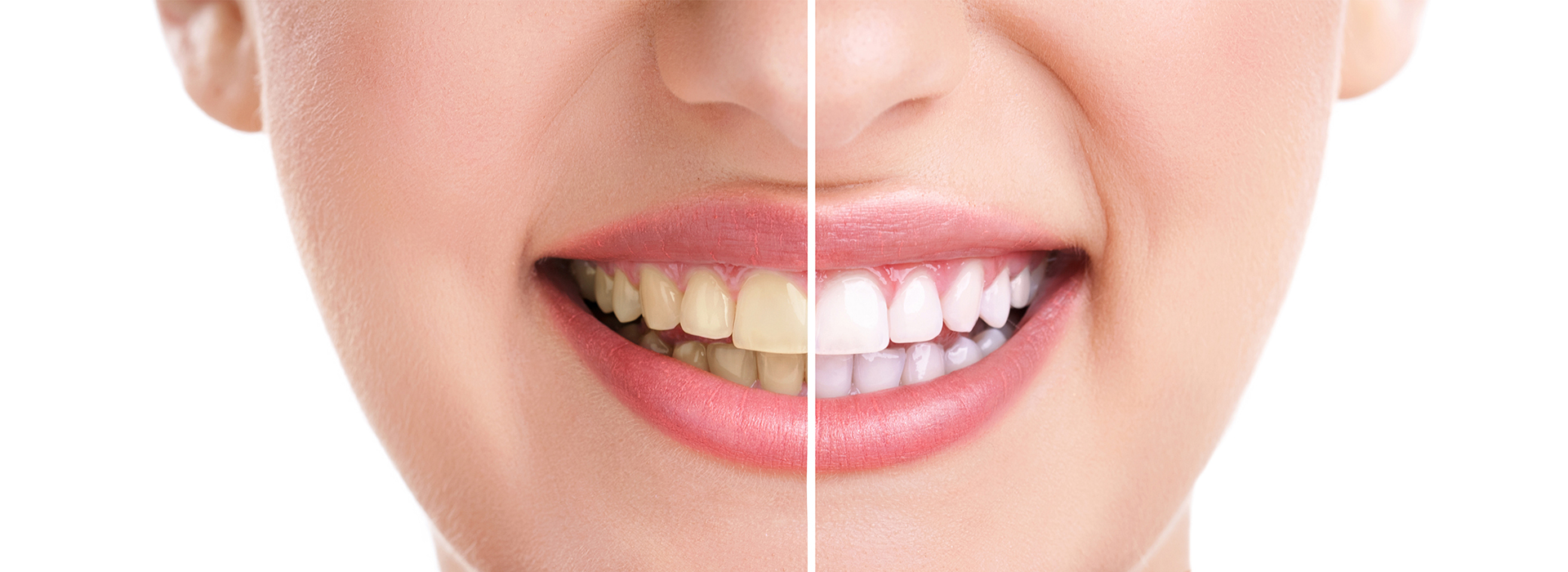 Central Park Dental Aesthetics | Laser Dentistry, Extractions and Complete   Partial Dentures