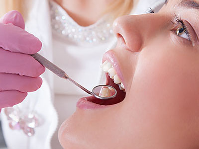 Central Park Dental Aesthetics | Sinus Augmentation, Restorations and Porcelain Crowns  Caps 